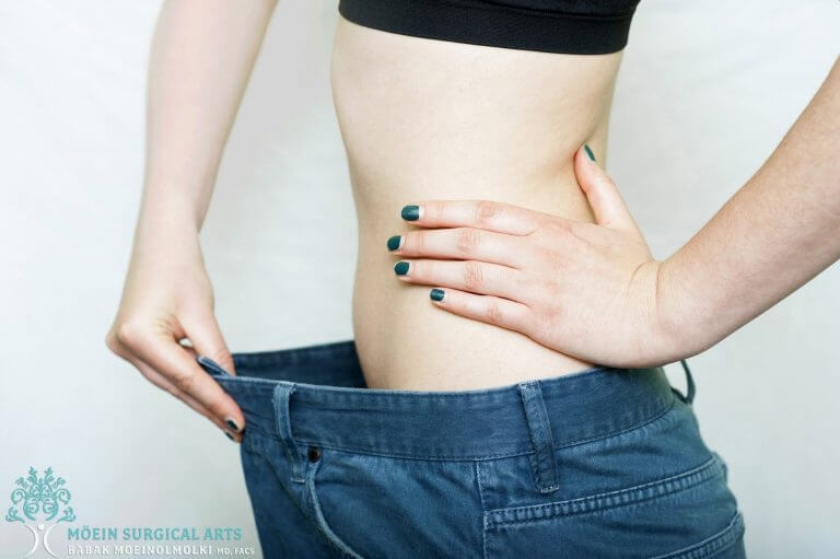 Liposuction of the Stomach - cost, prices and specials in Ventura County,  California