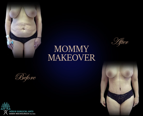 Mammy Makeover Los Angeles