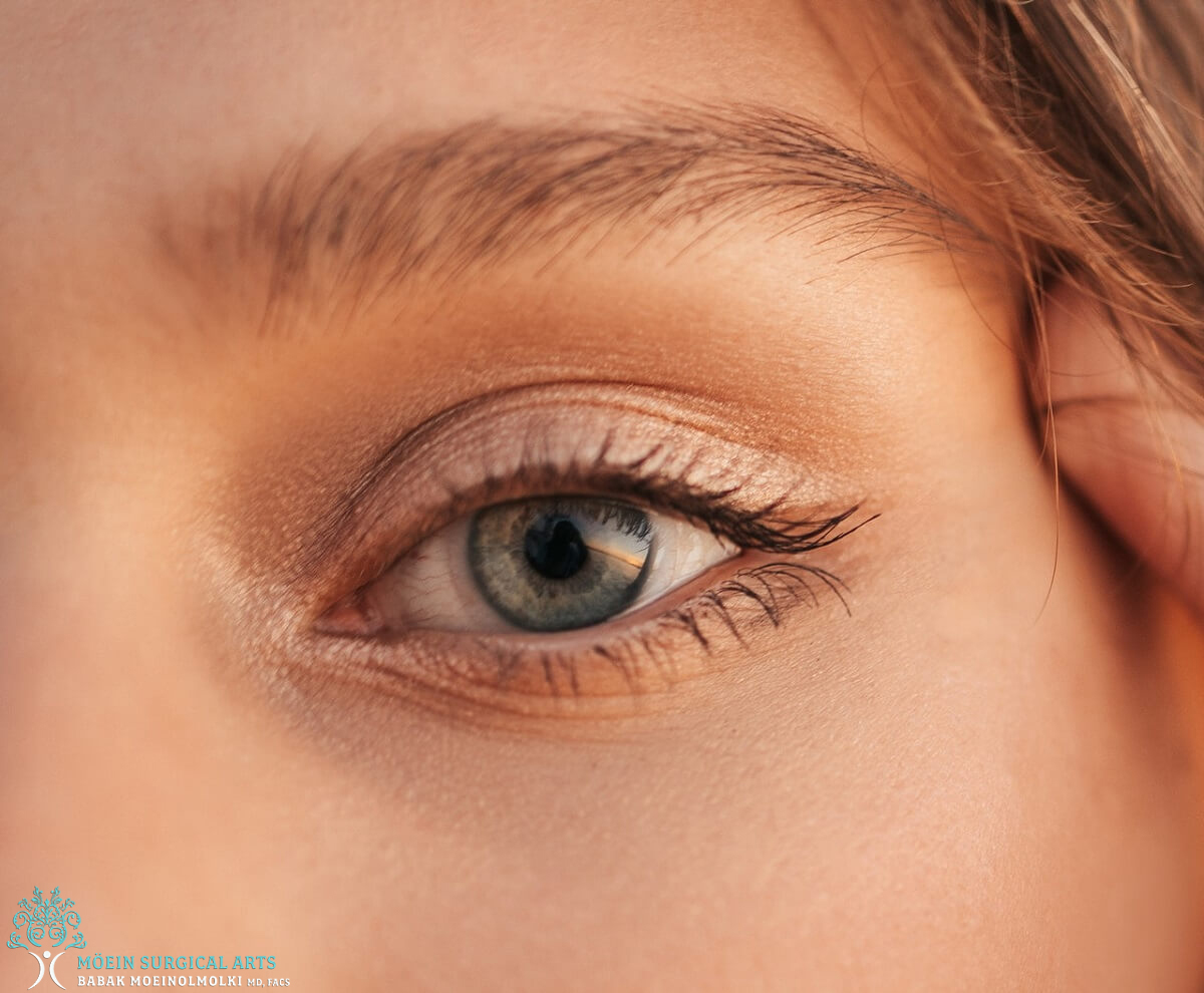 Eyelid Surgery