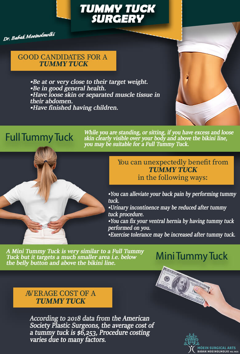 The Complete Tummy Tuck Recovery Guide - Berman Cosmetic Surgery
