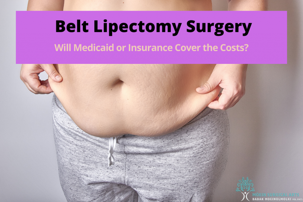 Belt Lipectomy Surgery Will Insurance Pay Los Angeles Ca Msa