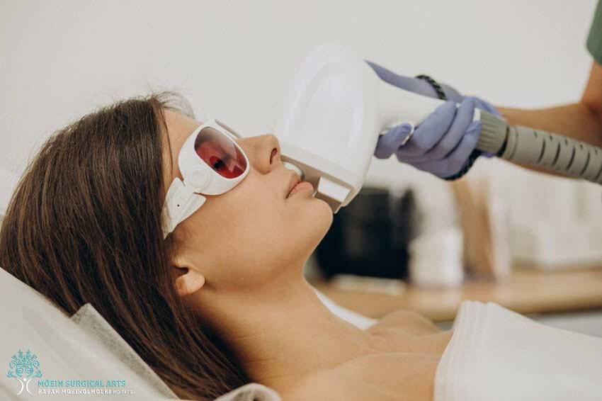 CO2 Fractional Laser Resurfacing in LA