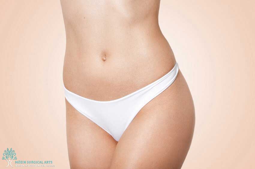 HD Lipo body- Los Angeles CA