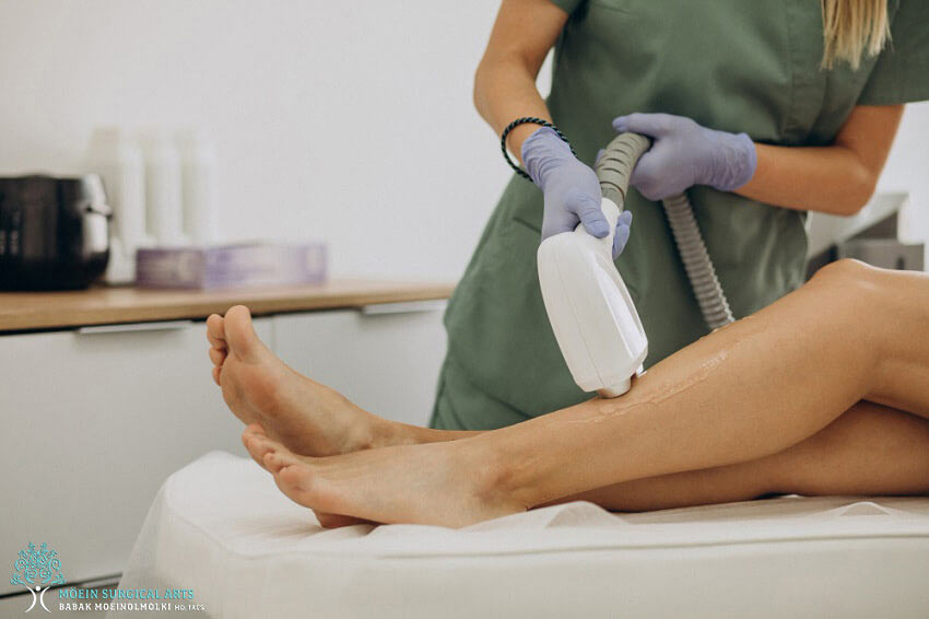 Laser Hair Removal Treatments