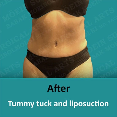 tumytuck-12 copia