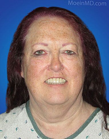 A woman with red hair is smiling in front of a blue background, showcasing a radiant smile.