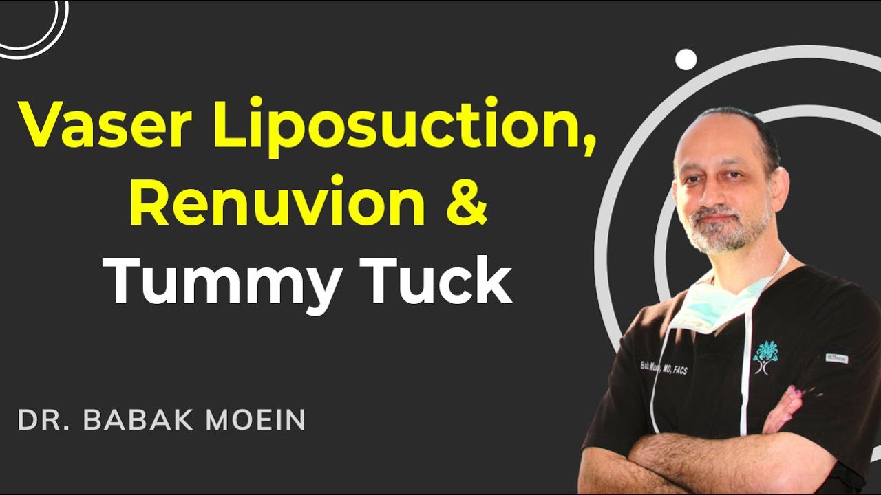 Revision tummy tuck with Renuvion for enhanced results.