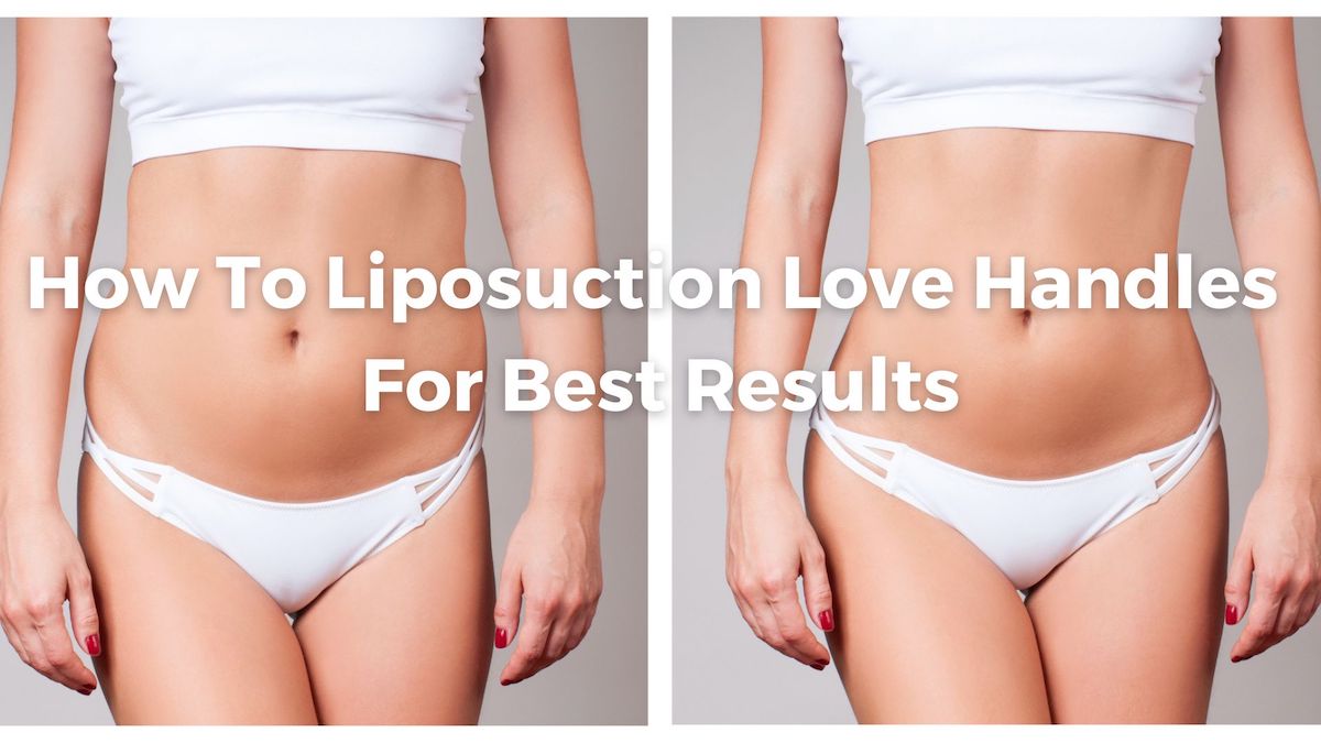 How To Liposuction Love Handles For Best Results - Moein Surgical Arts