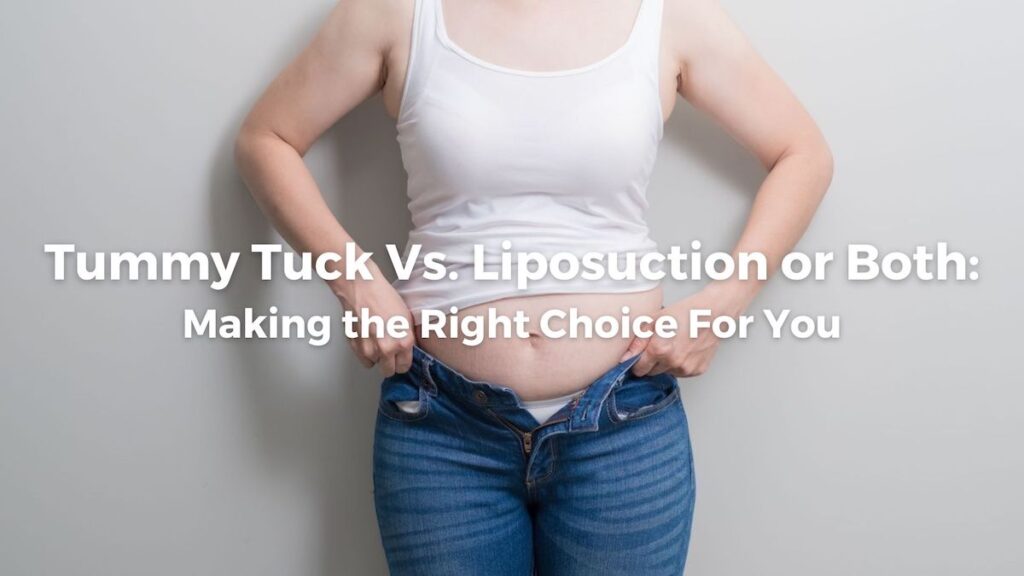 Tummy Tuck Vs. Liposuction, or both: What's the Right Choice for You?