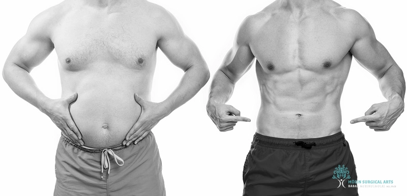 Ab Etching Procedure and Results in Los Angeles