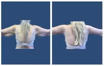 Rear view comparison of two women with different body types and arm positions against a blue background.