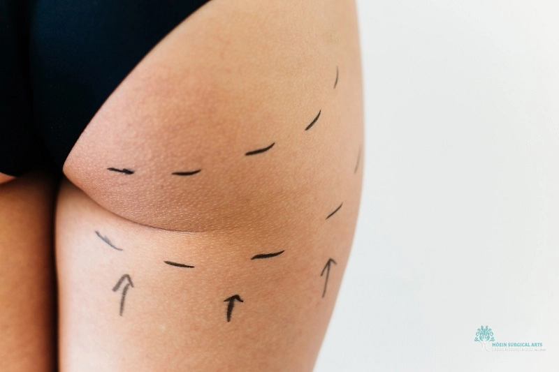 Banana Roll Fat FAQs