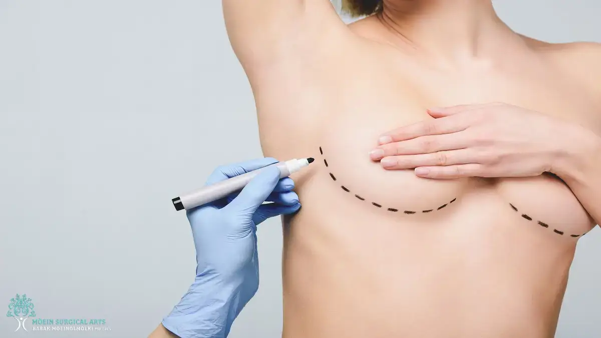 Benefits and Risks of Breast Augmentation Surgery in LA, CA