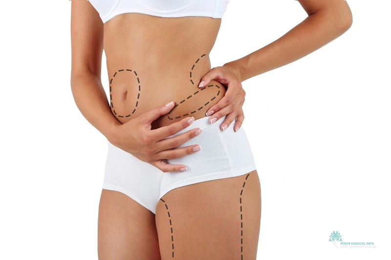 Body Contouring Customization in Los Angeles