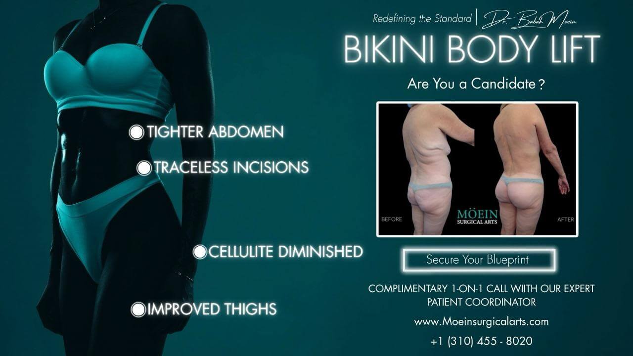 Body Lift in Los Angeles