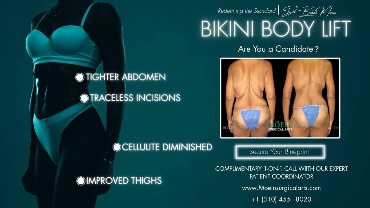 Body Lift in Los Angeles, CA Body Lift in Los Angeles, CA