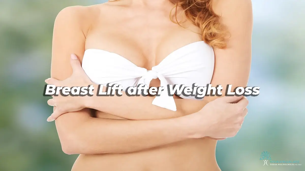 Breast Lift after Weight Loss in Los Angeles, CA