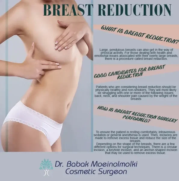 Breast reduction surgery's infographic