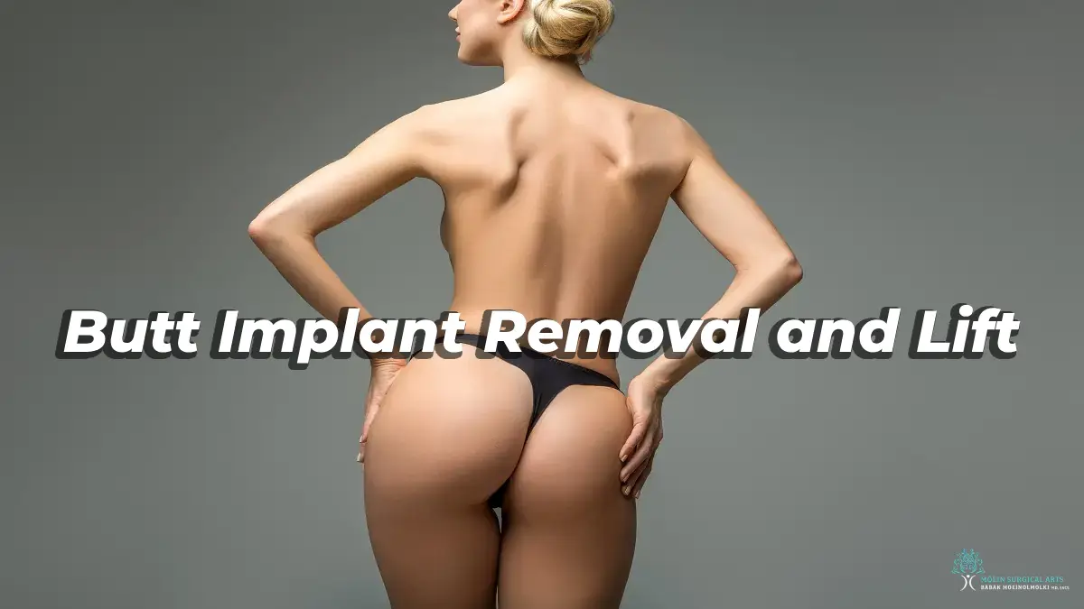 Butt Implant Removal and Lift in Los Angeles, CA