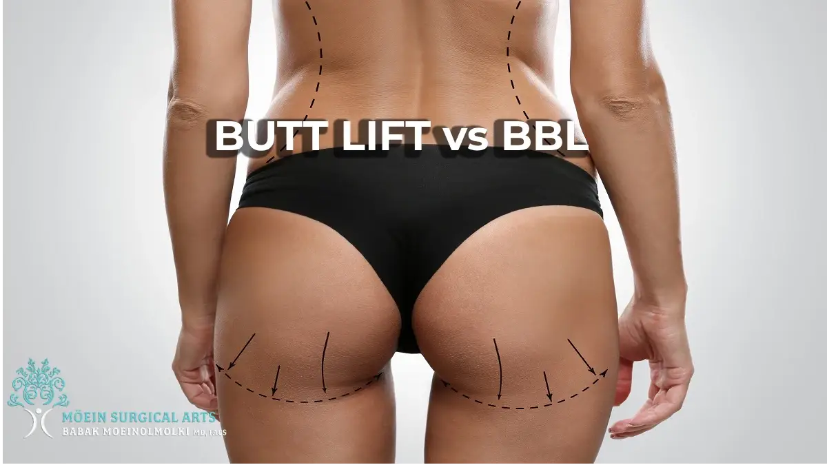 Butt Lift vs BBL- Los Angeles, CA
