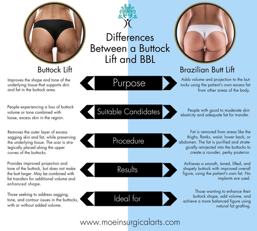 Buttock Lift vs BBL Buttock Lift vs BBL- Insight from Dr. Moein in Los Angeles, CA