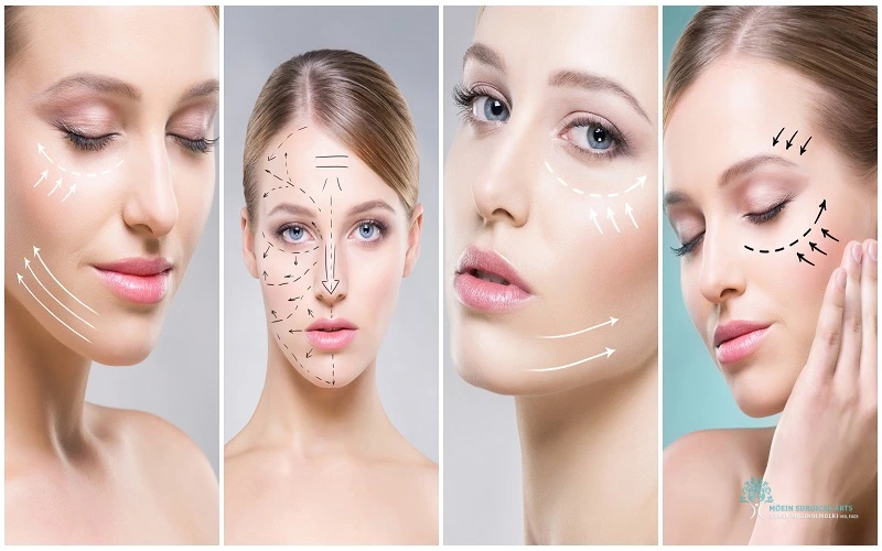 Combining Procedures for Full Facial Rejuvenation in LA