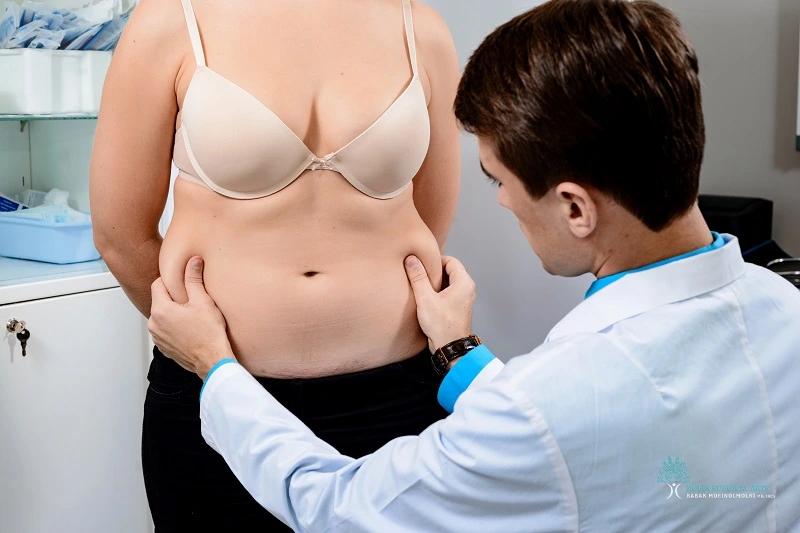 Diastasis Recti Surgery Options Consultation With Dr. Moein
