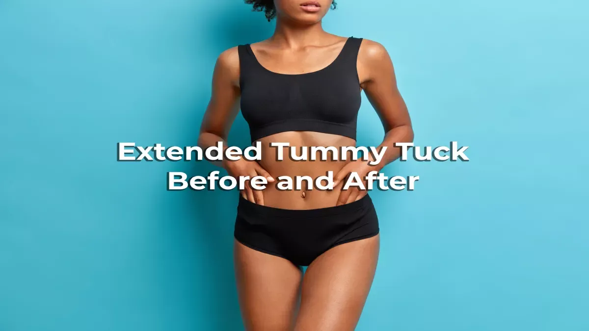 Extended Tummy Tuck Before and After