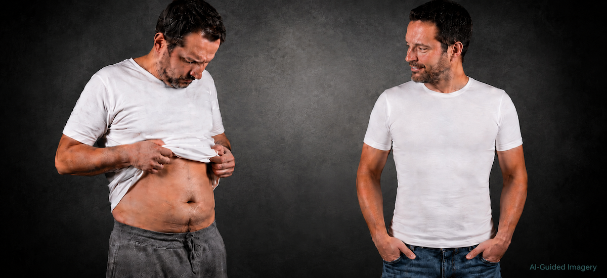 Male tummy tuck