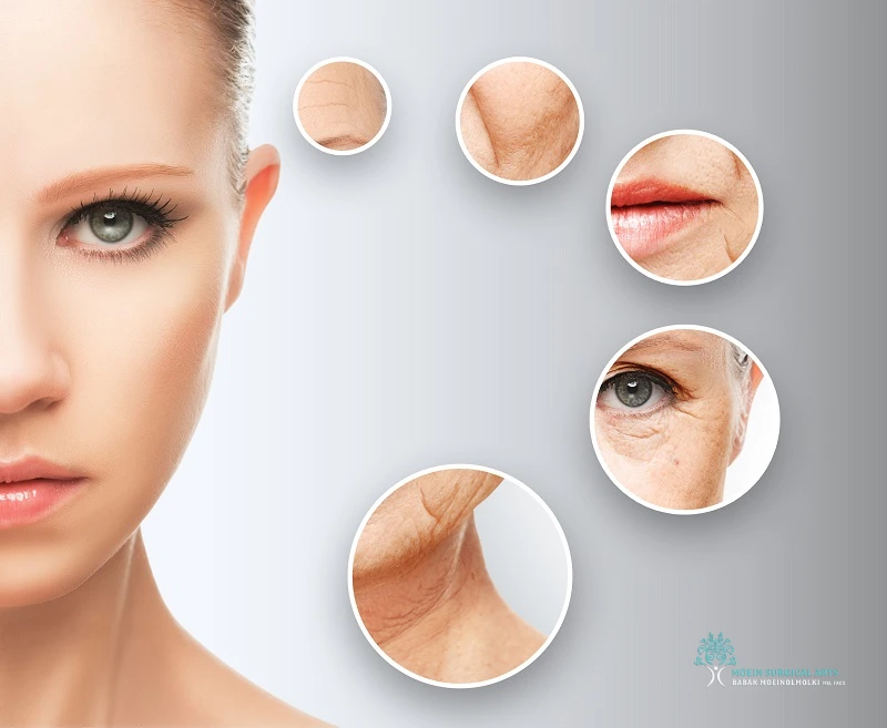 Facial Aging and the Need for Intervention