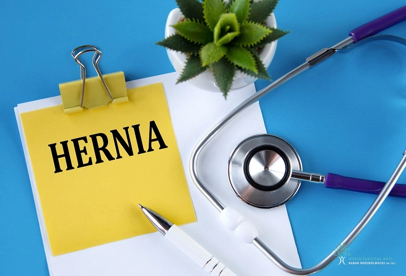 Hernia Repair by Dr. Moein in Los Angeles