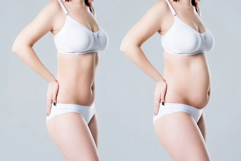 How Much is Lipo 360 in Los Angeles, CA