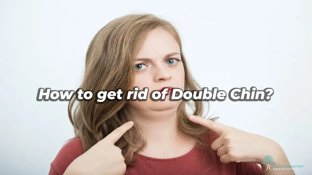 How to get rid of Double Chin? Los Angeles, CA