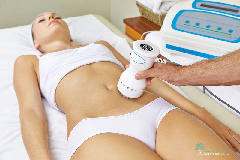 Laser Liposuction Recovery Time in LA