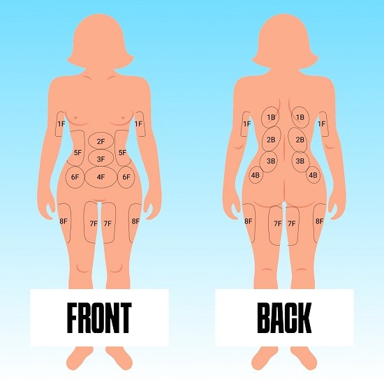 Body Diagram