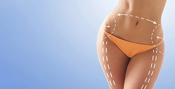 Best Liposuction Los Angeles
