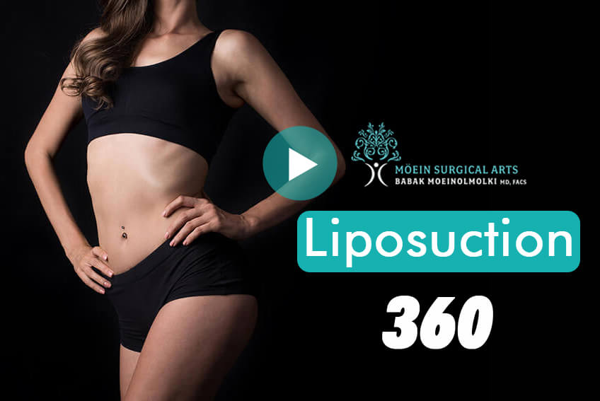 Liposuction-Los-Angeles-CA