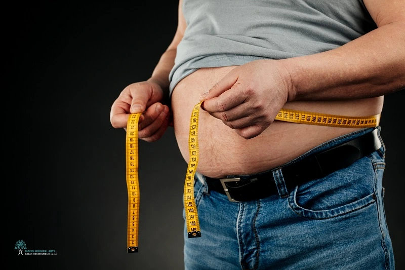 MALE LIPOSUCTION CANDIDATES
