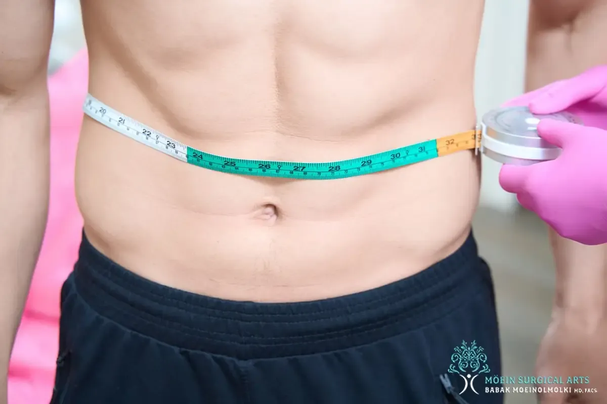 Male Tummy Tuck