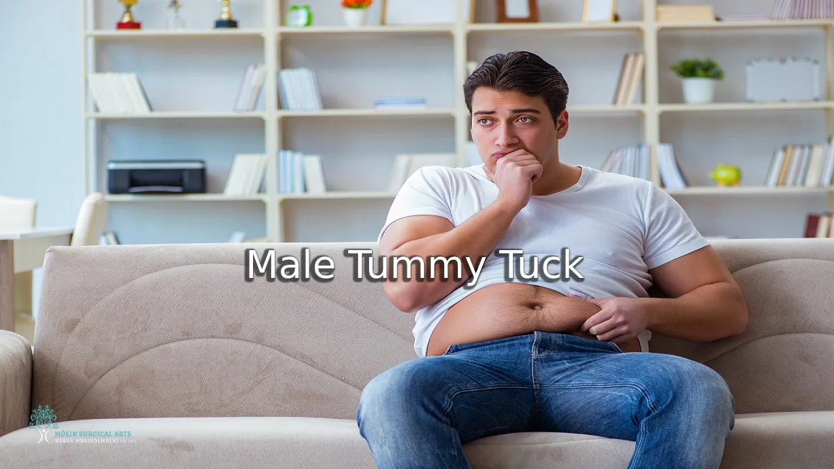 Male Tummy Tuck in Los Angeles