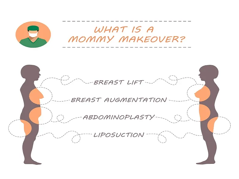 Mommy Makeover Cost Los Angeles, CA