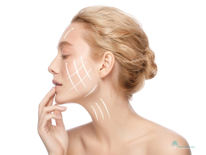 Neck Lift and Lower Facelift Recovery Pictures Day by Day