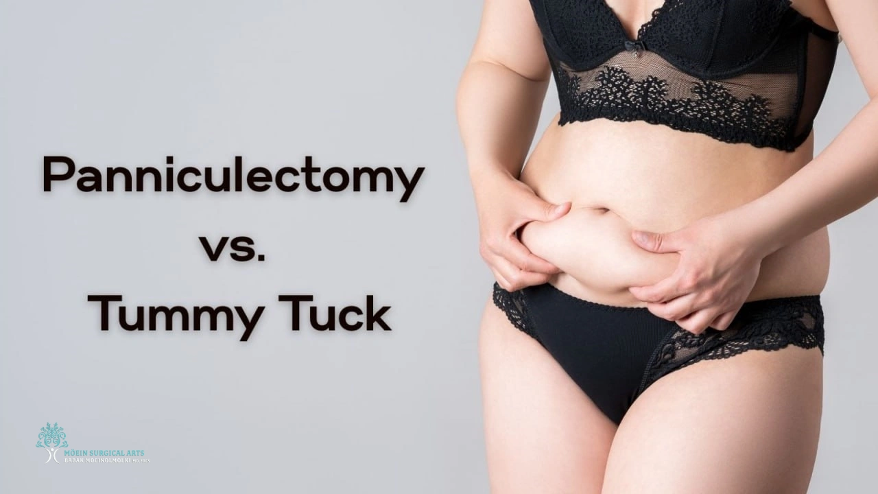 PANNICULECTOMY vs TUMMY TUCK- Insights from Dr. Moein in Los Angeles