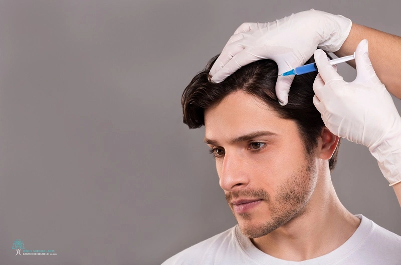 PRP Hair Treatment in Los Angeles