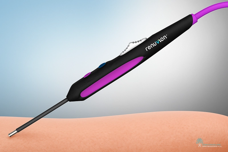 Renuvion for Wounds in LA by Dr. Moein