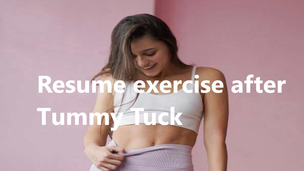 Resume exercise after tummy tuck.