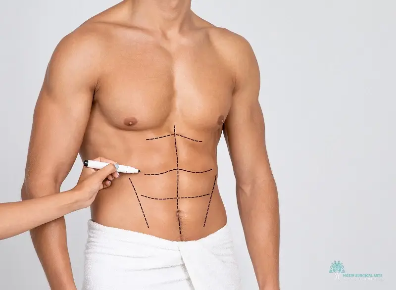 Six Pack Surgery Cost in Los Angeles