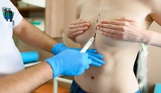 TRANSGENDER SURGERY in Los Angeles