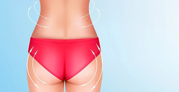 VASER liposuction Geo City