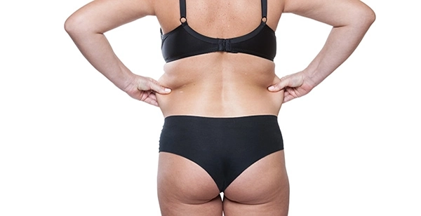 Abdominoplasty - Pasadena & Newport Beach